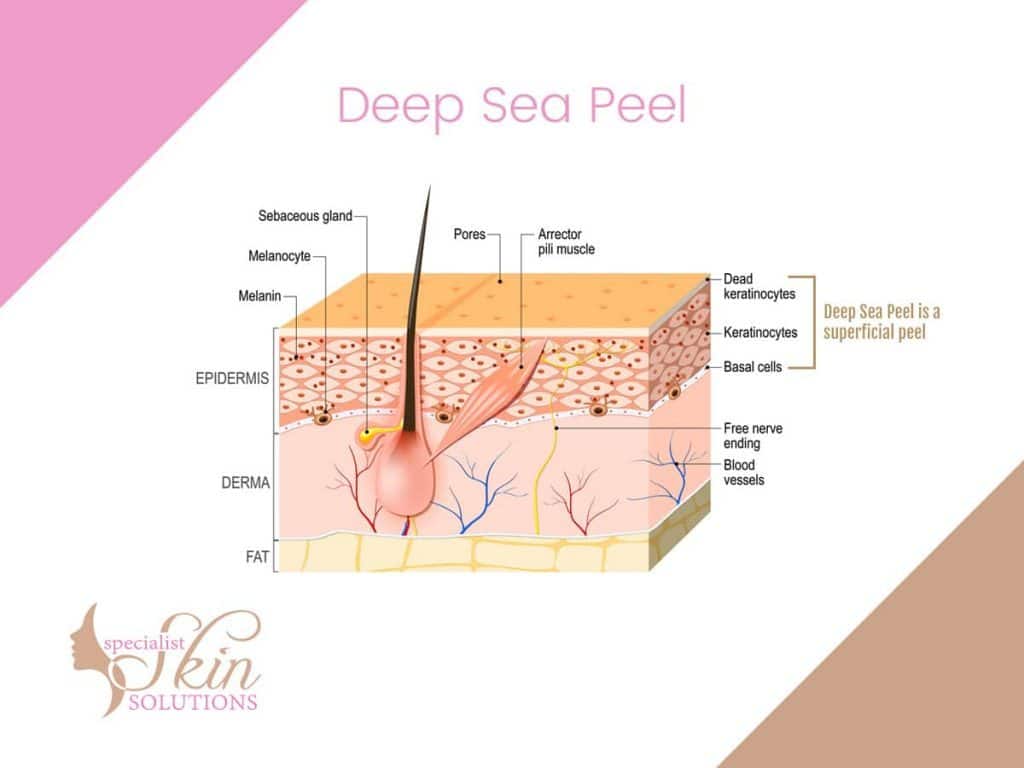 Deep Sea Peel by Dr Beldholm