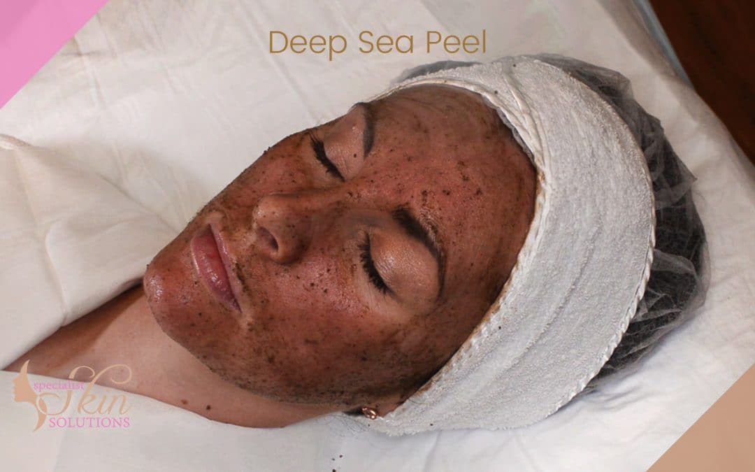 Deep Sea Peel by Dr Beldholm