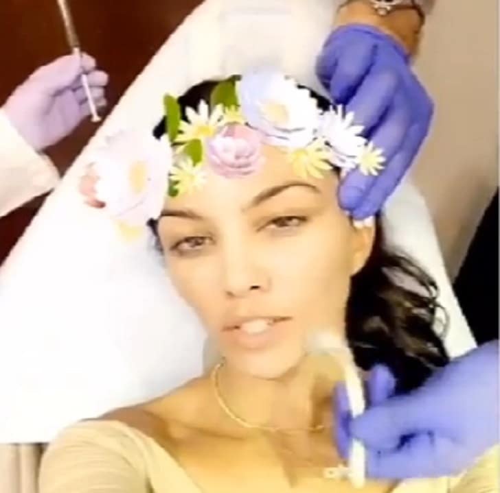 Kourtney Kardashian Vampire Facial