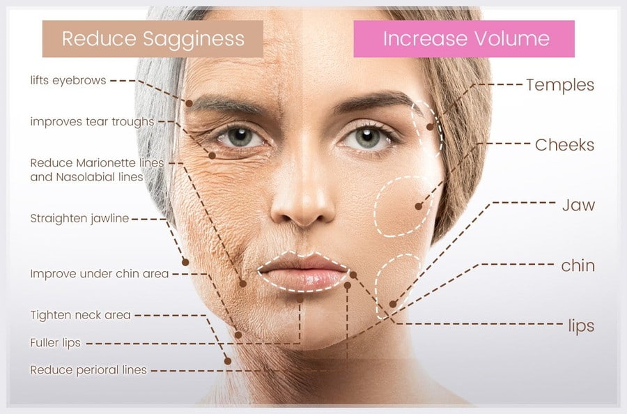 Liquid Facelift Graphics Specialist Skin Solutions