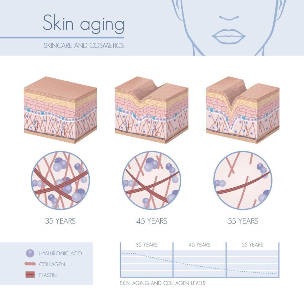 Skin Ageing Infographics