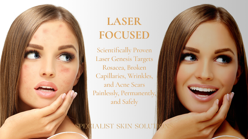 Laser Focused Laser Genesis