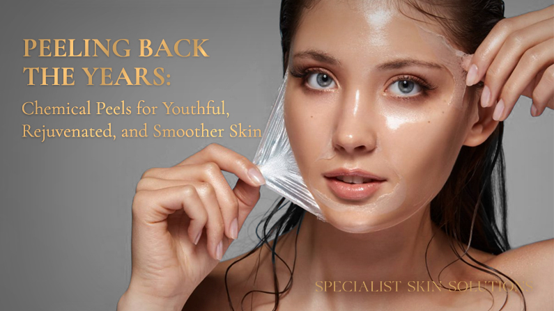 Peeling Back the Years