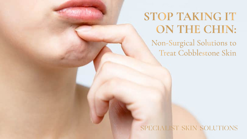 Stop Taking It On The Chin