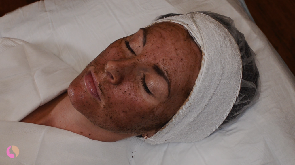 Radically different than a traditional peel