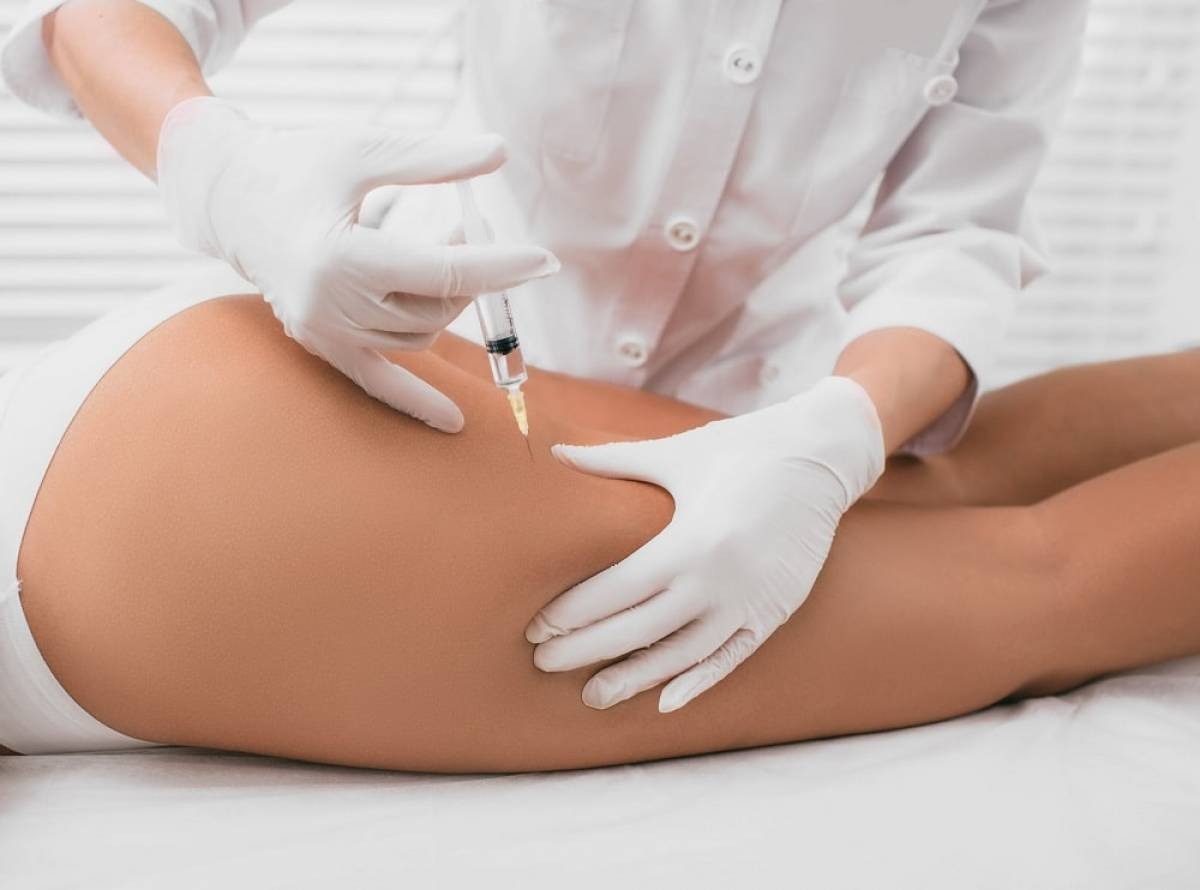 Cellulite treatment injection sites
